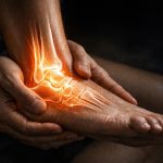 glucosamine sulfate 2kcl vs sodium chloride stabilized