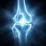 carnivore diet and joint health