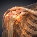 problem with most joint supplements